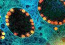‘IHU’: França identifica nova variante do coronavírus com mais de 40 mutações